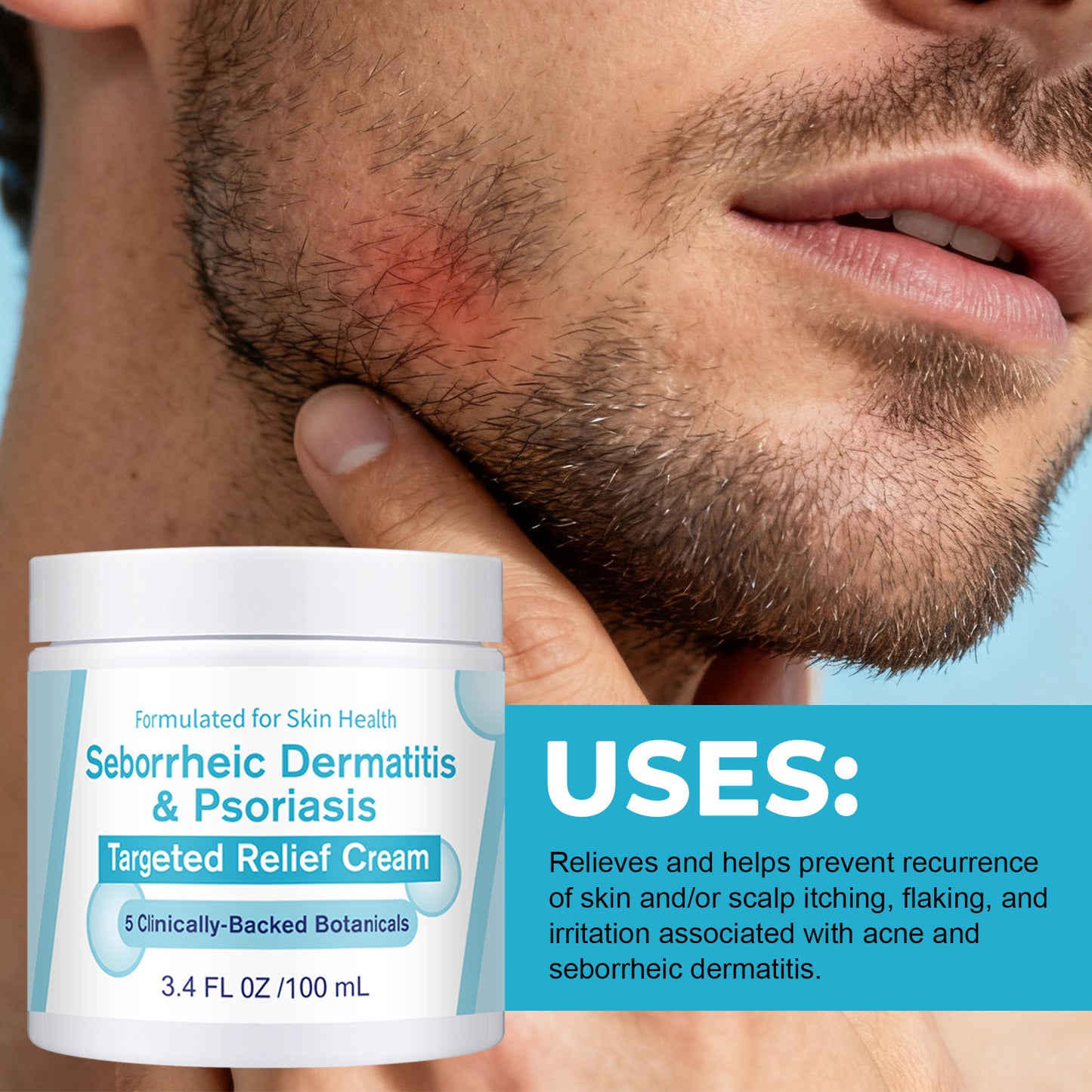 Seborrheic Dermatitis Skin Cream