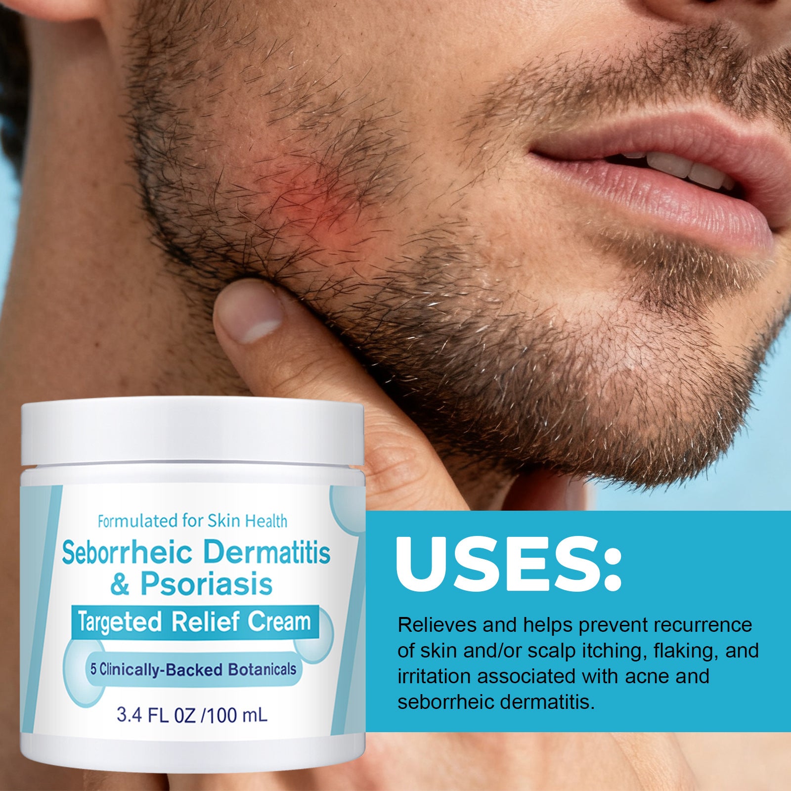 Seborrheic Dermatitis Skin Cream